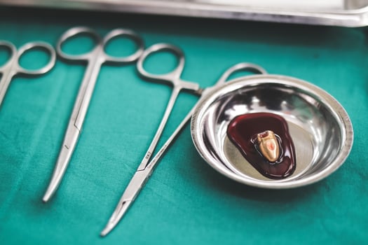 surgeon Remove the bullet from the patient's body in the operating room in the hospital. accident concept emergency surgery photo