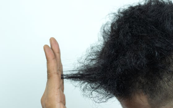 Close Up Young people have problems with hair loss, dryness, dullness, split ends and damage. photo