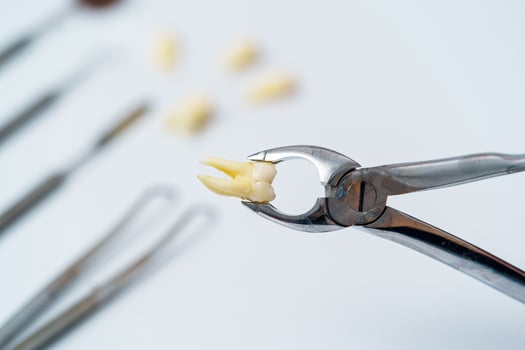 Tooth in tongs. Concept care isolated on white background. photo