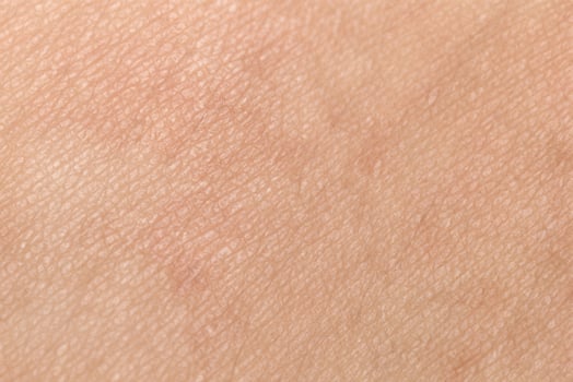 Close Up of Healthy Human Skin Texture with Natural Black Hairs, Ideal Background Concept photo
