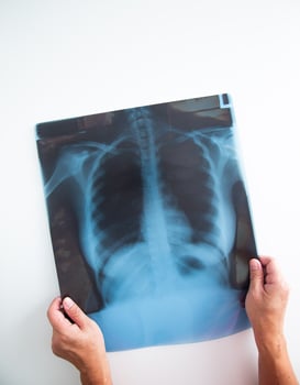 Medical doctor hand holding a x ray image. photo