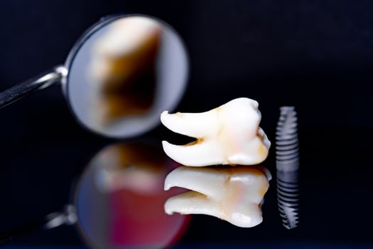 Dental implant model on black background and dental mirror. photo