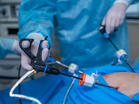 Robotic arm on front view. Surgeon providing operation. Neurosurgery and surgery concept. photo