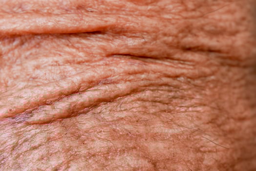aged man's skin with an abstract background texture. photo