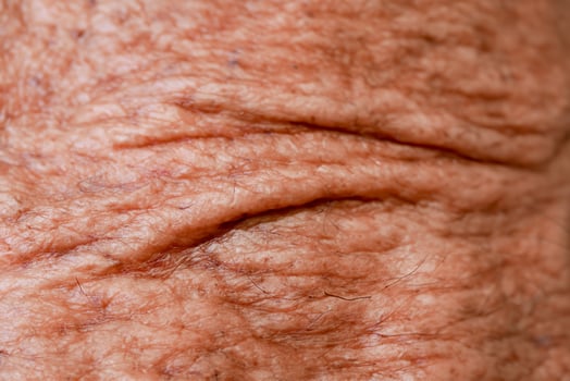 aged man's skin with an abstract background texture. photo
