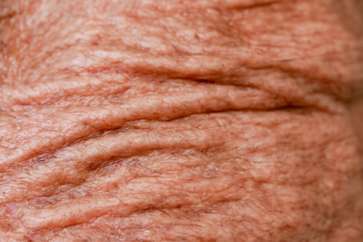 aged man's skin with an abstract background texture. photo