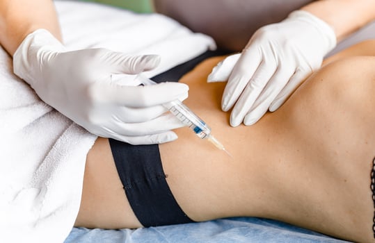 Beauty shots in the stomach for recovery by a doctor at the clinic. The concept of self-care photo