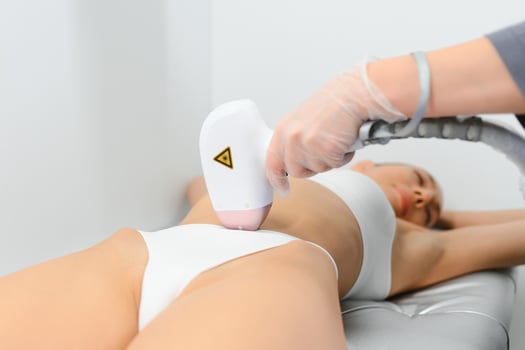 laser hair removal. Woman on laser hair removal treatments thighs and bikini area photo