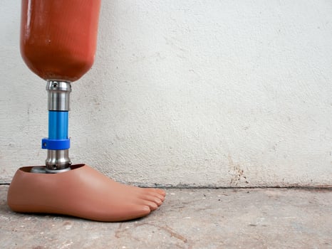 Prosthetic legs against the wall photo