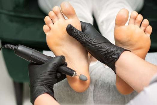 Peeling female feet. Hands of podiatry specialist in black gloves using special grinding equipment polish female foot from callus and corn in the beauty salon. photo