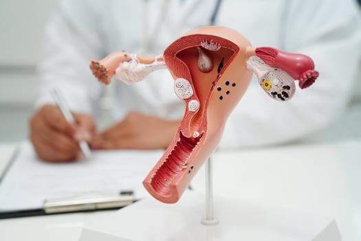 Uterus, doctor holding human anatomy model for study diagnosis and treatment in hospital. photo