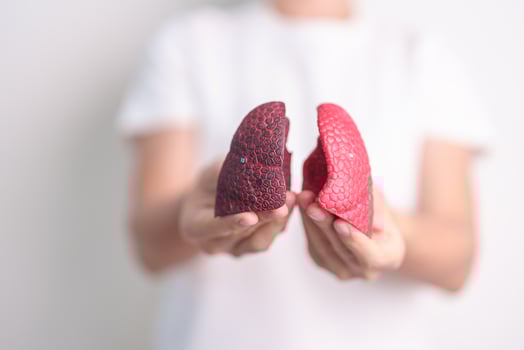 woman hold Smoker anatomy for Disease. Lung Cancer, Asthma, Chronic Obstructive Pulmonary or COPD, Bronchitis, Emphysema, Cystic Fibrosis, Bronchiectasis, Pneumonia and world Lung day concept photo