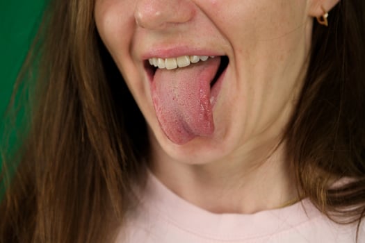 portrait of young woman with tongue out on green background photo
