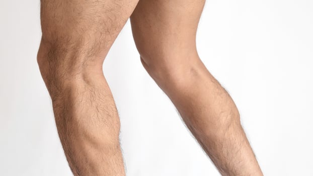 Muscular legs of a man, calves of both feet seen from the side, with a white background and space for text photo