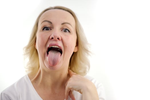 a woman shows her tongue healthy clean tongue Female tongue with a white coating. isolated on white background. Gastrointestinal disease, organ dysfunction, poor oral hygiene, fungal infections photo