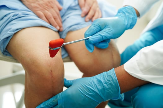 Asian doctor knock on knee reflex nerve for check and treatment senior patient in hospital. photo