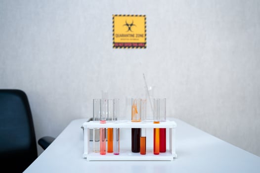 Various colors chemical test tubes in rack at lab photo