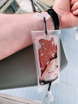 Young man making blood donation in hospital, focus on hand. Male donor gives blood in a mobile blood donation center photo