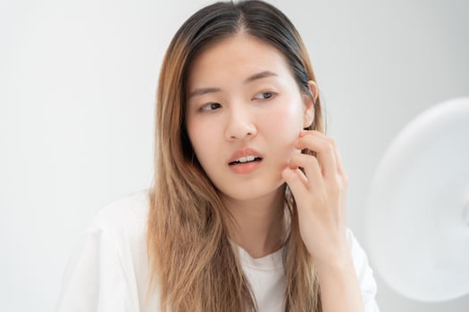Woman worried about face Dermatology, rosacea dermatitis, allergic steroids, sensitive skin, red face from sunburn, acne, dry skin, large pores ,rash face, dull, freckles, wrinkle, skin problem photo