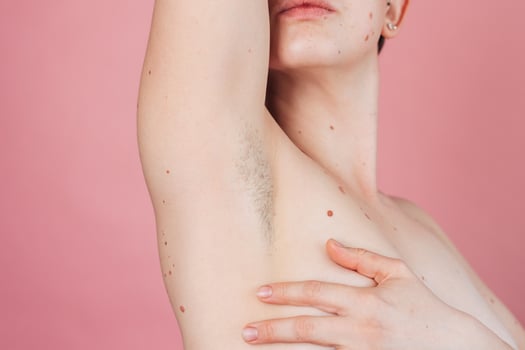A young beautiful shirtless woman showing off her hairy armpits on an isolated pink background. photo