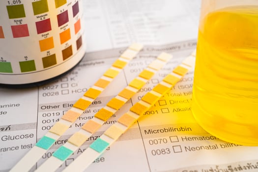 Urinalysis, urine cup with reagent strip pH paper test and comparison chart in laboratory. photo