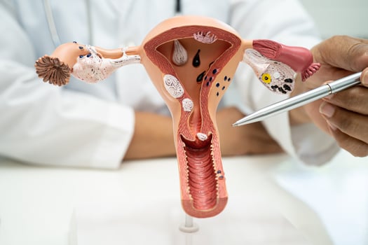 Uterus, doctor with anatomy model for study diagnosis and treatment in hospital. photo