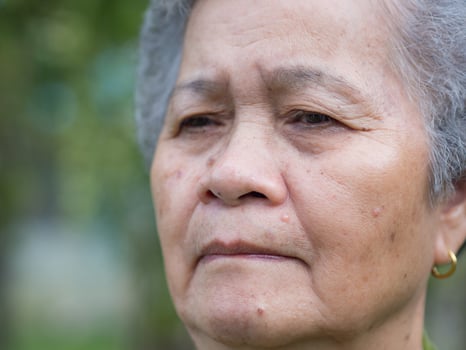 Close-up of face elderly woman with short white hair, feeling worry and standing in garden. Asian senior woman unhealthy and make her unhappy. Concept of old people and healthcare photo