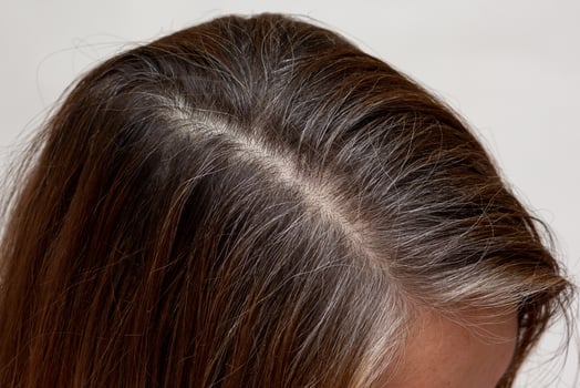 Top view of regrowth root with grey hair photo