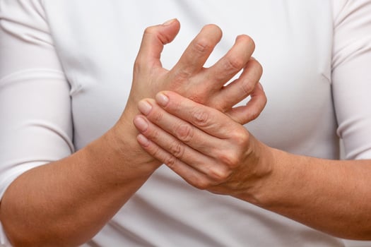 Woman hands showing hand with arthritis photo