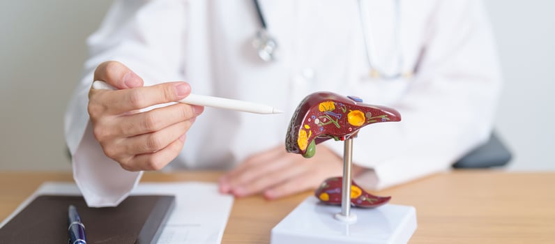 Doctor with human Liver anatomy model. Liver cancer and Tumor, Jaundice, Viral Hepatitis A, B, C, D, E, Cirrhosis, Failure, Enlarged, Hepatic Encephalopathy, Ascites Fluid in Belly and health concept photo