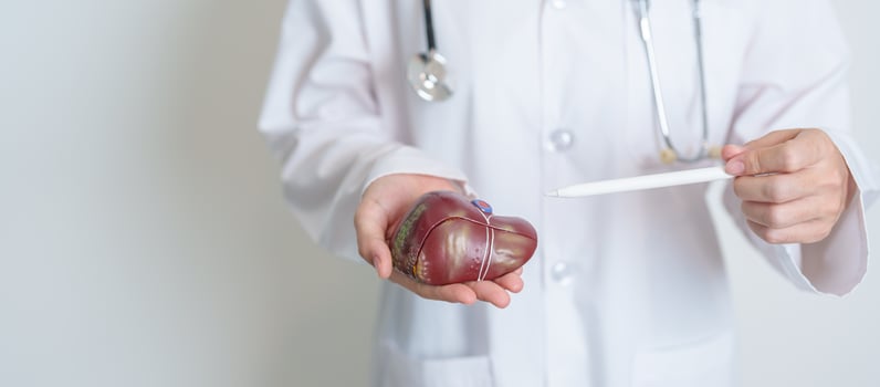 Doctor holding human Liver anatomy model. Liver cancer and Tumor, Jaundice, Viral Hepatitis A, B, C, D, E, Cirrhosis, Failure, Enlarged, Hepatic Encephalopathy, Ascites Fluid in Belly and health photo