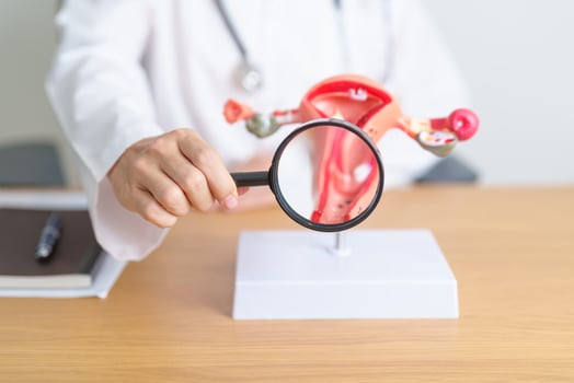 Doctor with Uterus and Ovaries anatomy model and magnifying glass. Ovarian and Cervical cancer, Cervix disorder, Endometriosis, Hysterectomy, Uterine fibroids, Reproductive system, Pregnancy photo