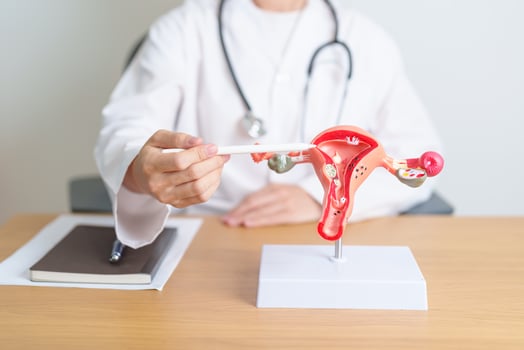 Doctor with Uterus and Ovaries anatomy model. Ovarian and Cervical cancer, Cervix disorder, Endometriosis, Hysterectomy, Uterine fibroids, Reproductive system, Pregnancy and health concept photo