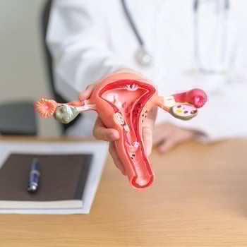 Doctor with Uterus and Ovaries anatomy model. Ovarian and Cervical cancer, Cervix disorder, Endometriosis, Hysterectomy, Uterine fibroids, Reproductive system, Pregnancy and health concept photo