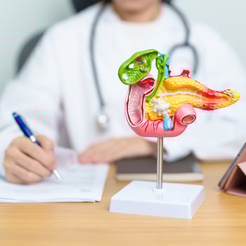 Doctor with human Pancreatitis anatomy model with Pancreas, Gallbladder, Bile Duct, Duodenum, Small intestine and tablet. Pancreatic cancer, acute pancreatitis and Digestive system photo