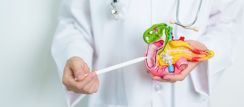 Doctor with human Pancreatitis anatomy model with Pancreas, Gallbladder, Bile Duct, Duodenum, Small intestine. Pancreatic cancer, Acute and Chronic pancreatitis, Digestive system and Health concept photo