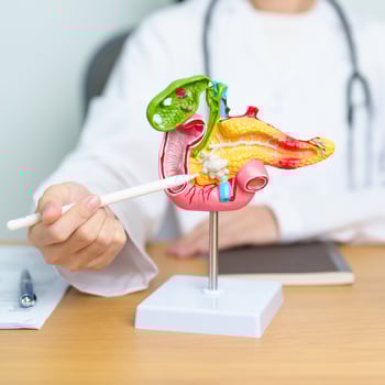 Doctor with human Pancreatitis anatomy model with Pancreas, Gallbladder, Bile Duct, Duodenum, Small intestine and tablet. Pancreatic cancer, acute pancreatitis and Digestive system photo