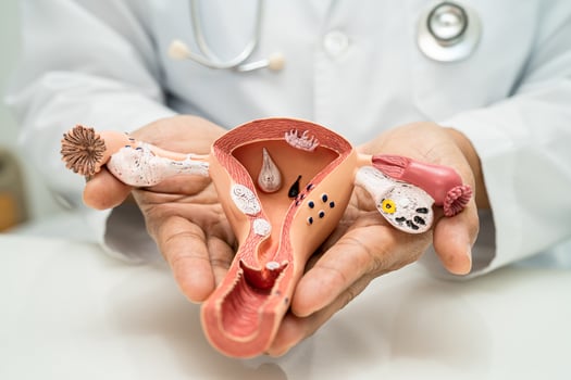 Uterus, doctor with anatomy model for study diagnosis and treatment in hospital. photo