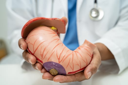 Stomach disease, doctor with anatomy model for study diagnosis and treatment in hospital. photo