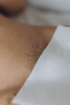 Bikini waxing,Intimate waxing, Hair removal, bikini area. Cosmetic Beauty Clinics photo