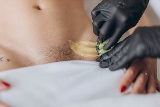 Bikini waxing,Intimate waxing, Hair removal, bikini area. Cosmetic Beauty Clinics photo