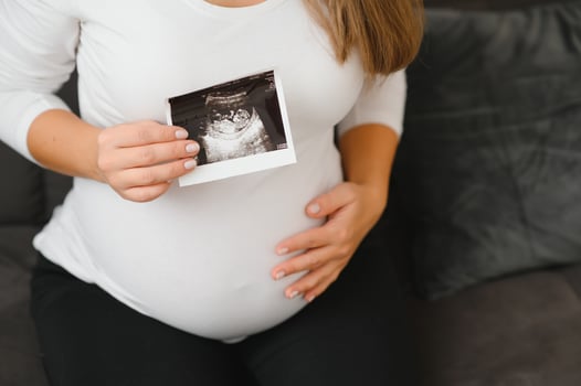 Pregnant woman hands holding ultrasound photo