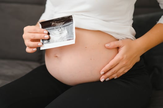 Pregnant women holding echo pictures in hand photo