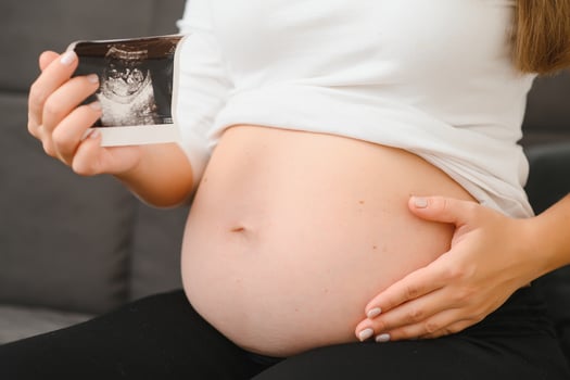 Pregnant women holding echo pictures in hand photo