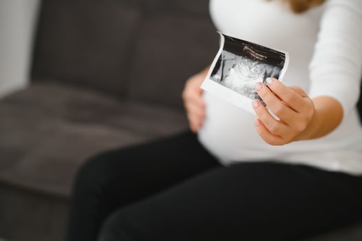 Pregnant woman hands holding ultrasound photo