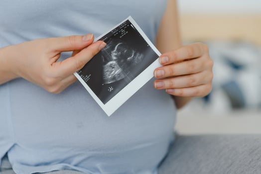 Pregnant woman is holding her stomach and a photo of her Ultrasound