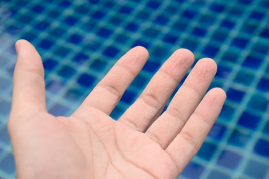 Symptom pruney and wrinkled skin hand and finger from water on blue pool swimming background at morning sunrise,Skin symptoms of hands and fingerprints,Healthy looking hands,Skin treatment. photo