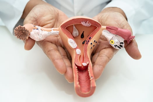 Uterus, doctor with anatomy model for study diagnosis and treatment in hospital. photo