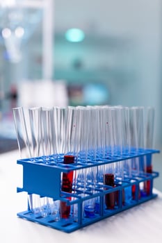 Medical test tube with blood standing on table during chemistry molecular examination in microbiology hospital laboratory. Biochemistry genetics infection. Healthcare treatment photo