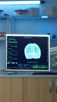 Neurology medical clinic with nobody in it modernly equipped prepared for treatment innovation of nervous. System using high tech and microbiology tools for scientific research in laboratory photo